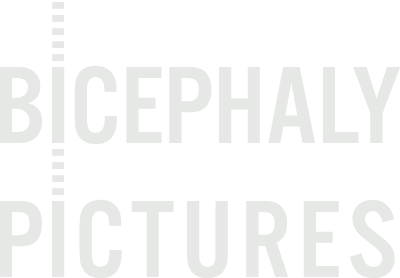 Bicephaly Pictures
